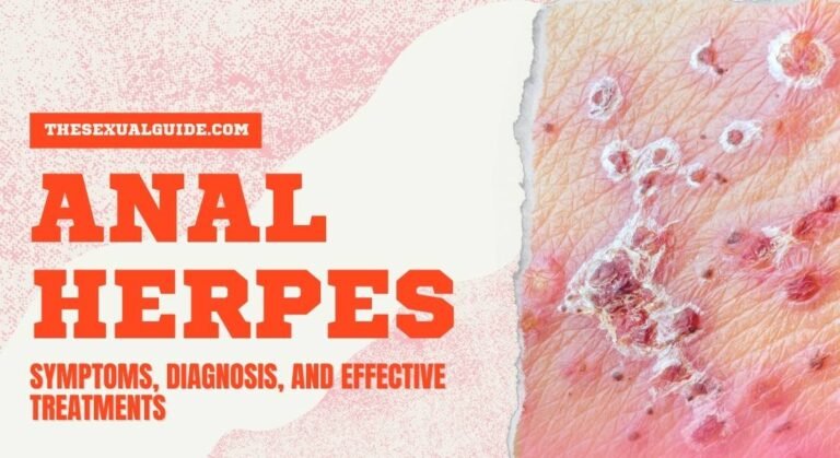 Anal Herpes: Symptoms, Diagnosis, and Effective Treatments